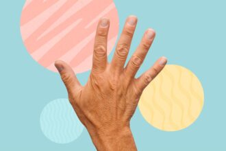 What’s the Difference Between Tremors and Dyskinesia in Advanced Parkinson’s Disease?