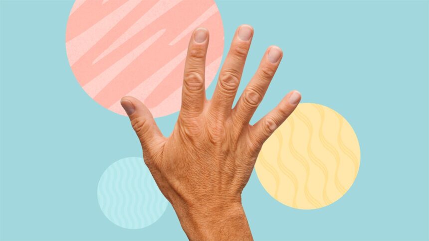 What’s the Difference Between Tremors and Dyskinesia in Advanced Parkinson’s Disease?